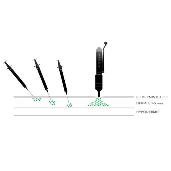 Hovedbilde QF-HA MESO SERUM NON-CROSS LINKED 1,5% 5ml