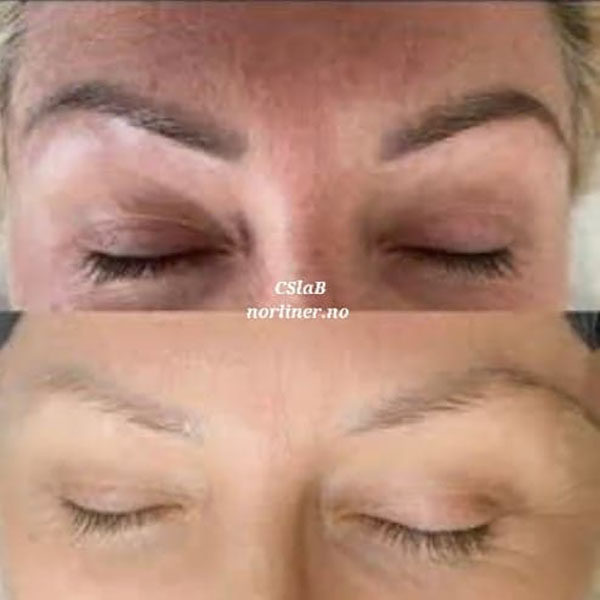 Hovedbilde NL-CSLAB RETOUCH ERASER PIGMENTFJERNINGSLØSNING Ampulle 8ml