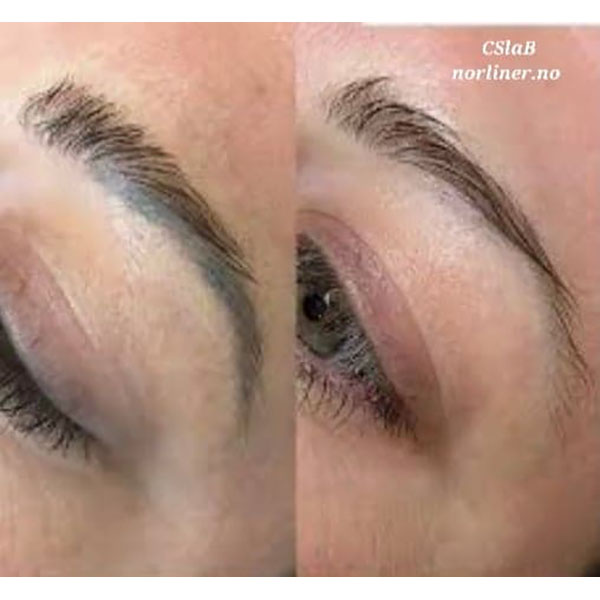 Hovedbilde NL-CSLAB RETOUCH ERASER PIGMENTFJERNINGSLØSNING Ampulle 8ml