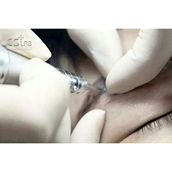 Hovedbilde NL-CSLAB RETOUCH ERASER PIGMENTFJERNINGSLØSNING Ampulle 8ml