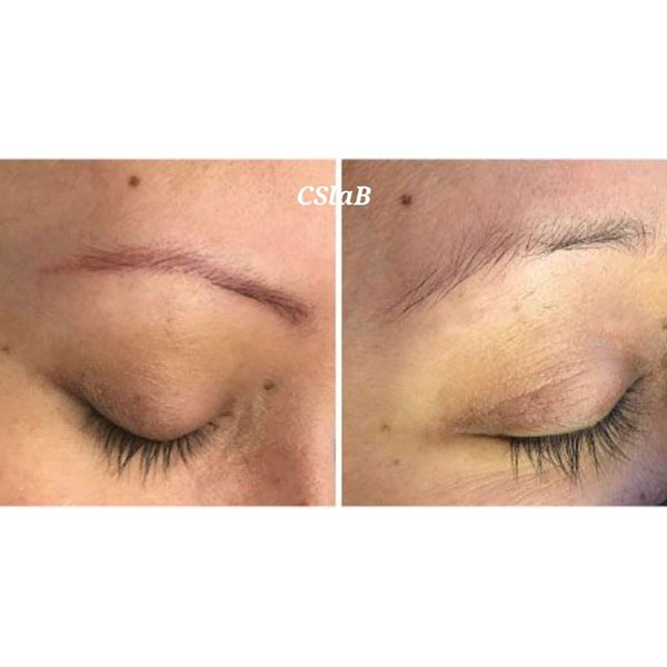 Hovedbilde NL-CSLAB RETOUCH ERASER PIGMENTFJERNINGSLØSNING Ampulle 8ml