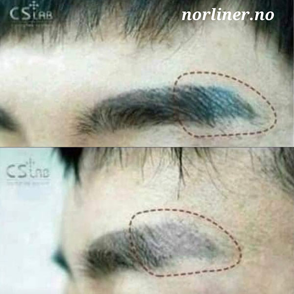 Hovedbilde NL-CSLAB RETOUCH ERASER PIGMENTFJERNINGSLØSNING Ampulle 8ml