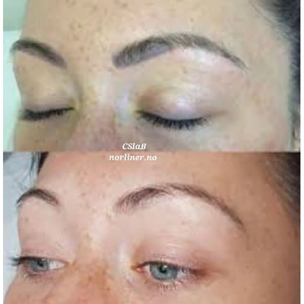 Hovedbilde NL-CSLAB RETOUCH ERASER PIGMENTFJERNINGSLØSNING Ampulle 8ml
